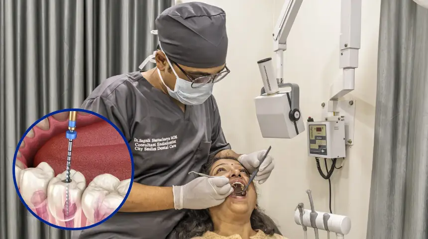 how root canal treatment removes infection and saves the tooth