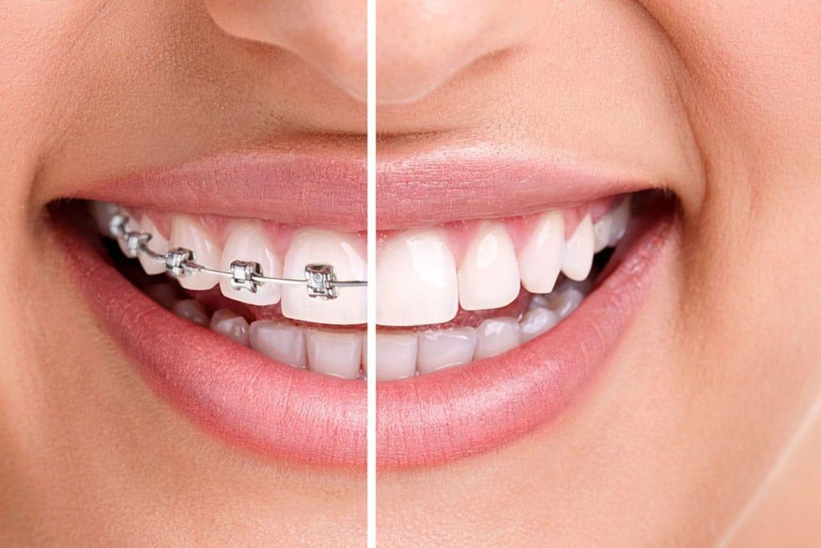 Orthodontic Treatment in South Kolkata
