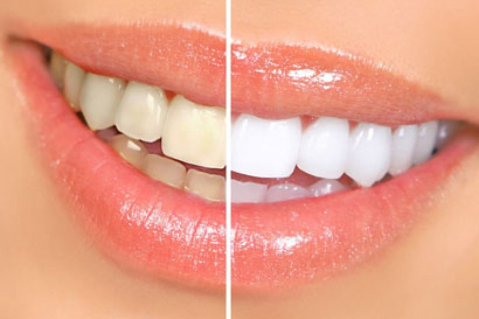 Cosmetic Dentistry in South Kolkata