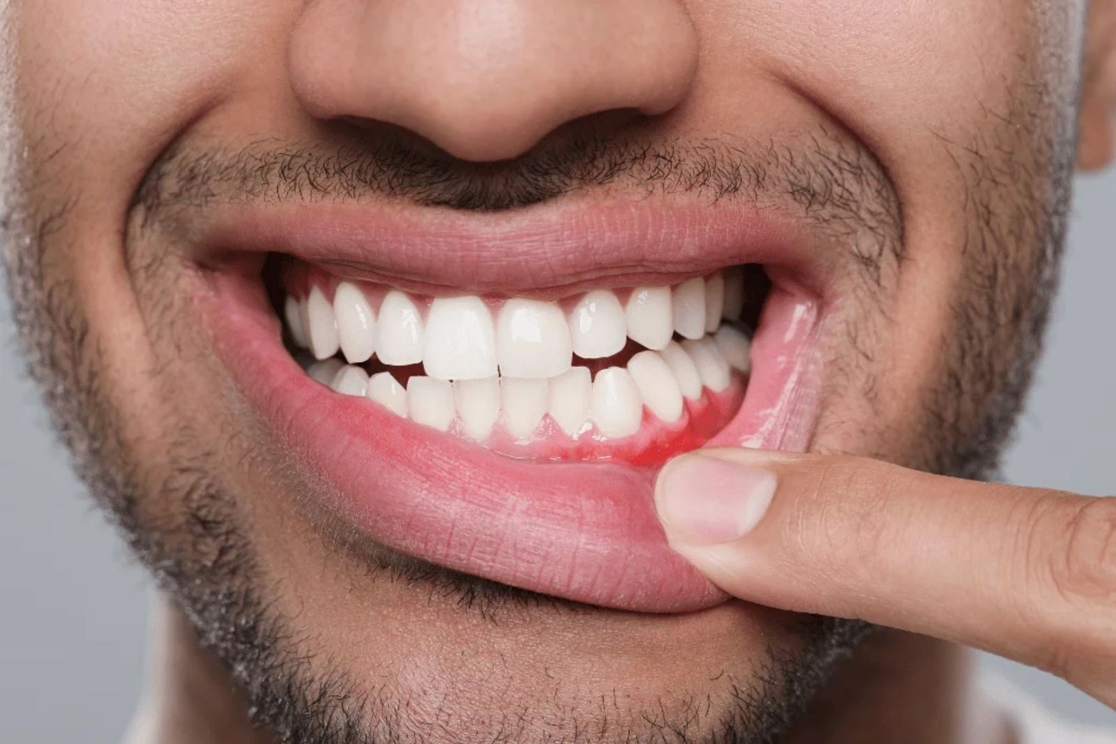 Gum Treatment in South Kolkata