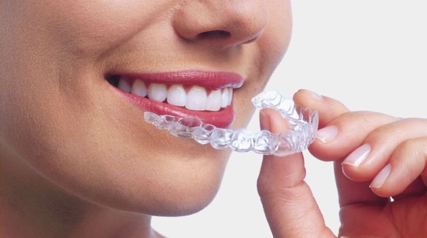 Invisible Braces in South Kolkata