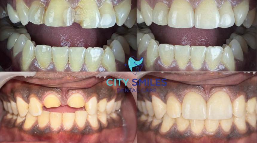 Cosmetic Dentistry