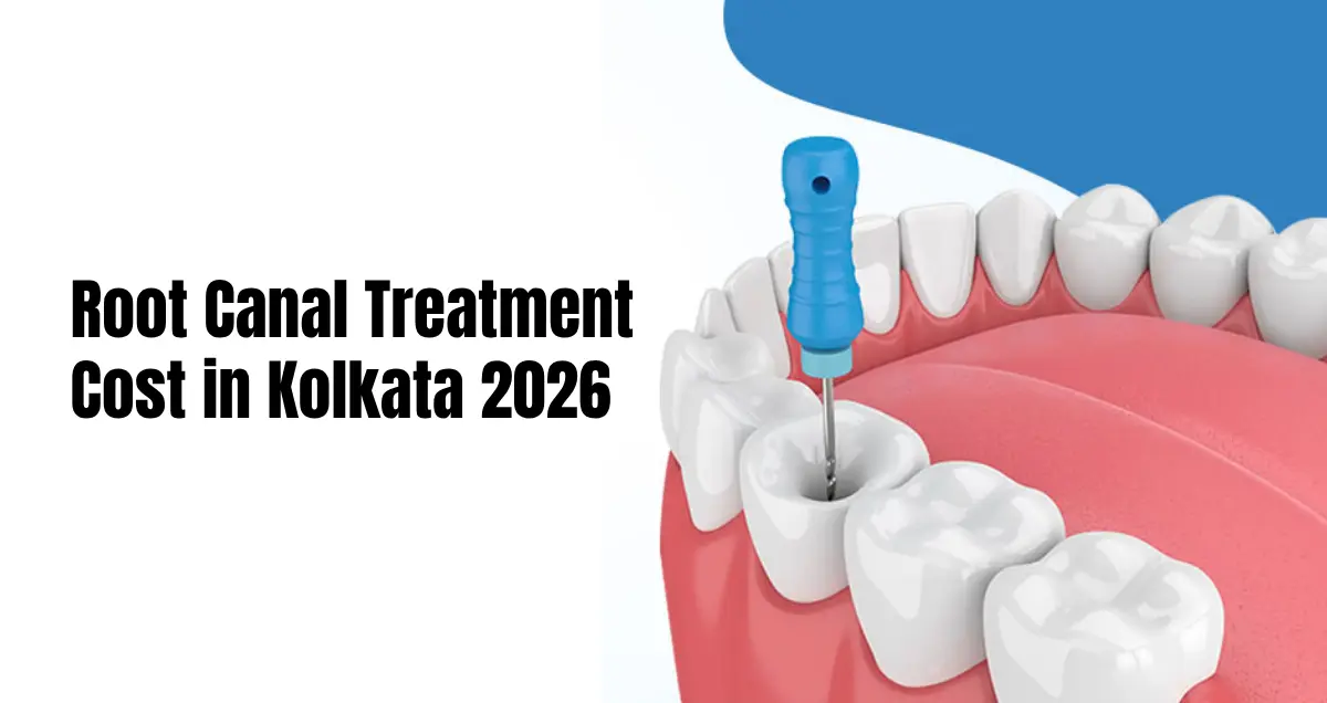 root canal treatment cost in Kolkata