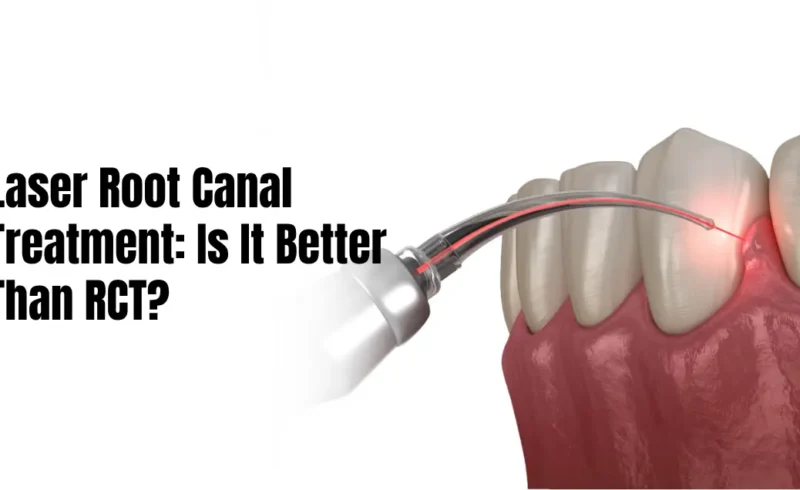 Laser root canal treatment