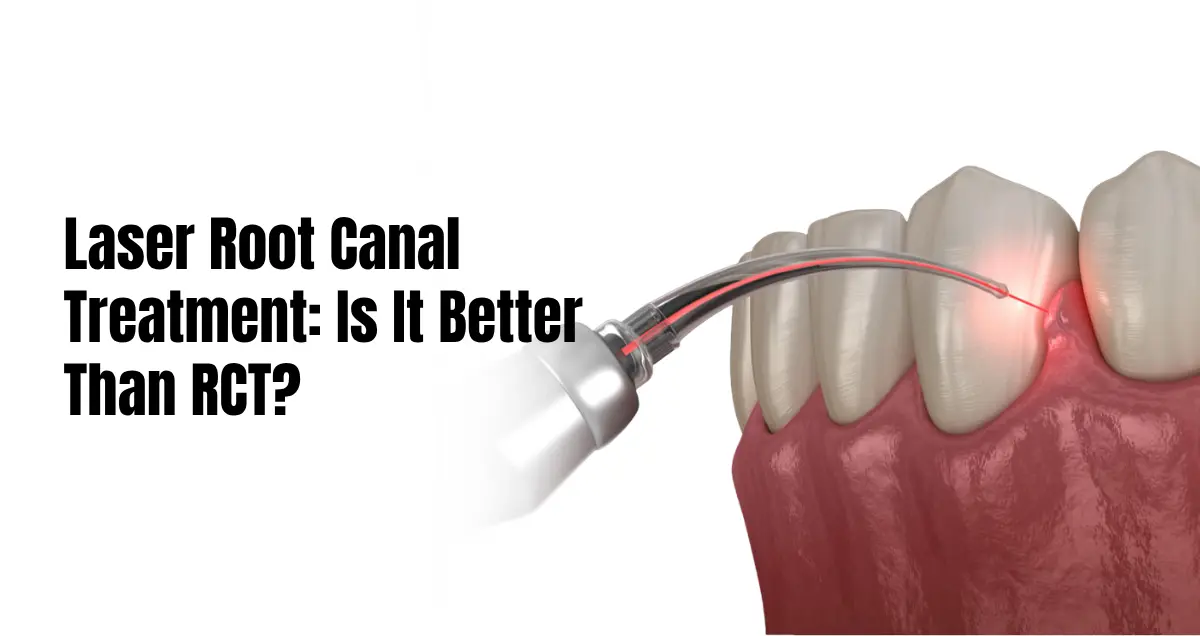 Laser root canal treatment