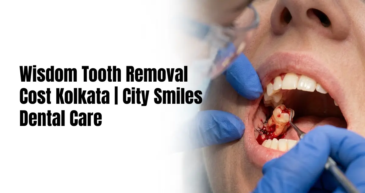 Wisdom Tooth Removal Cost in Kolkata