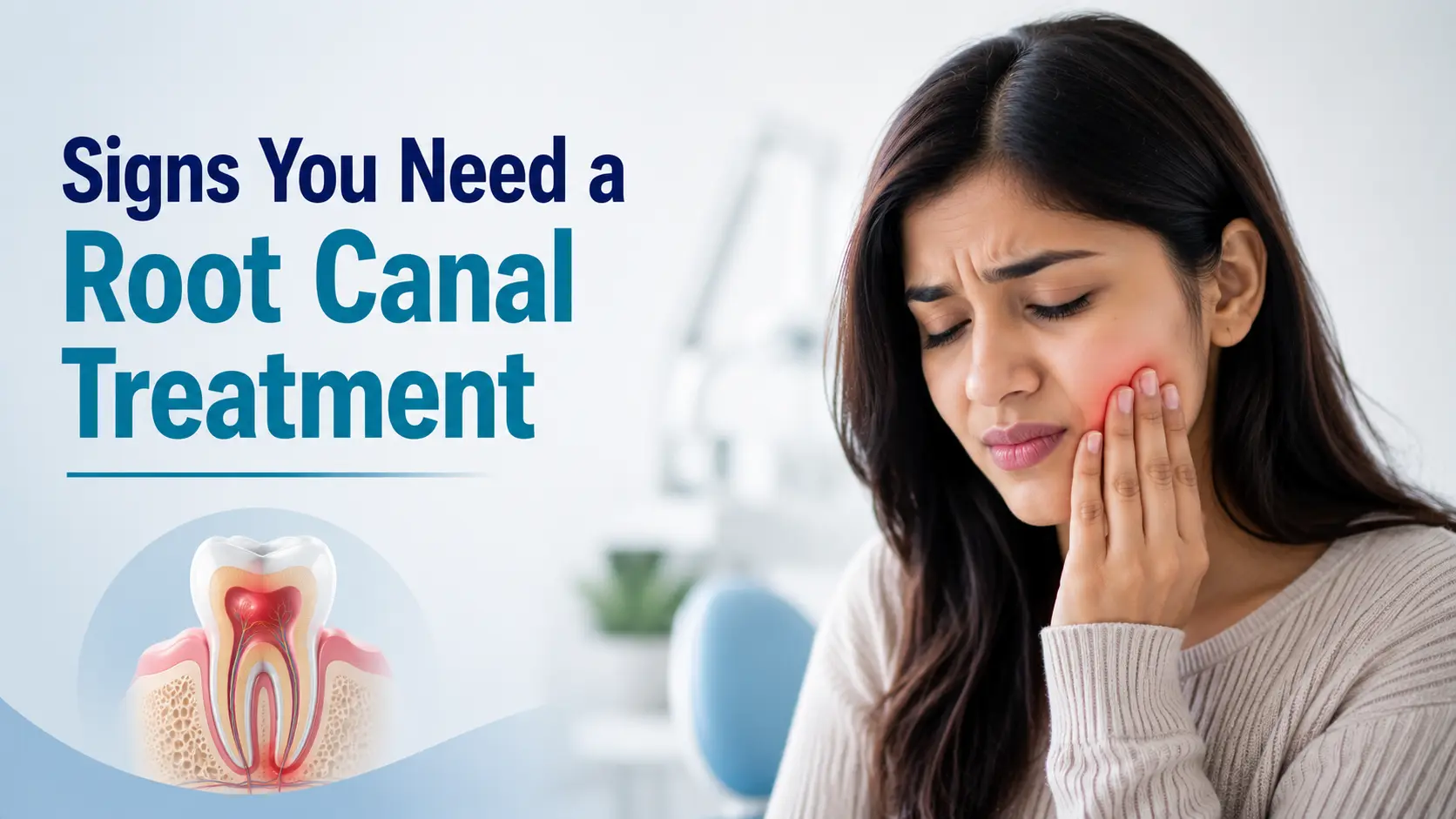 Signs You Need a Root Canal