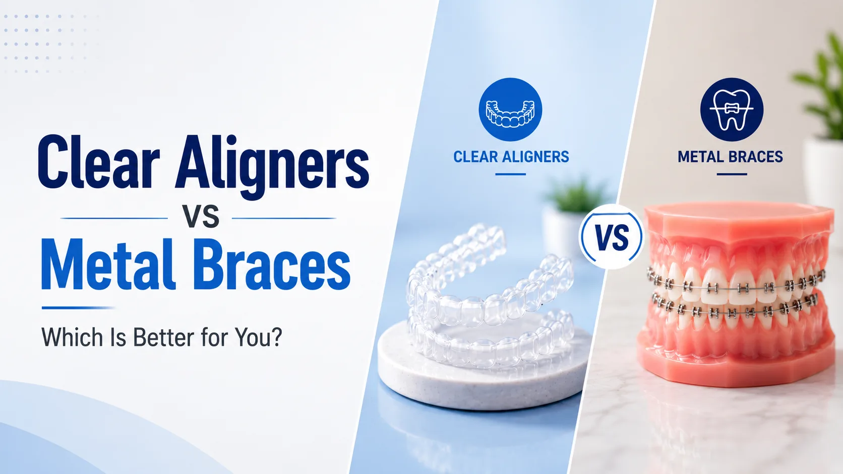 Clear Aligners vs Metal Braces